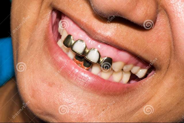 La morena de los dientes de oro