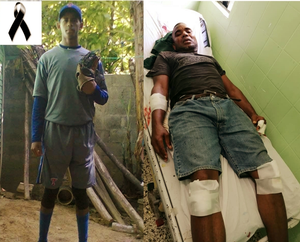 Muere joven pelotero en Imbert, futbolista resulta herido a machetazos en Montellano