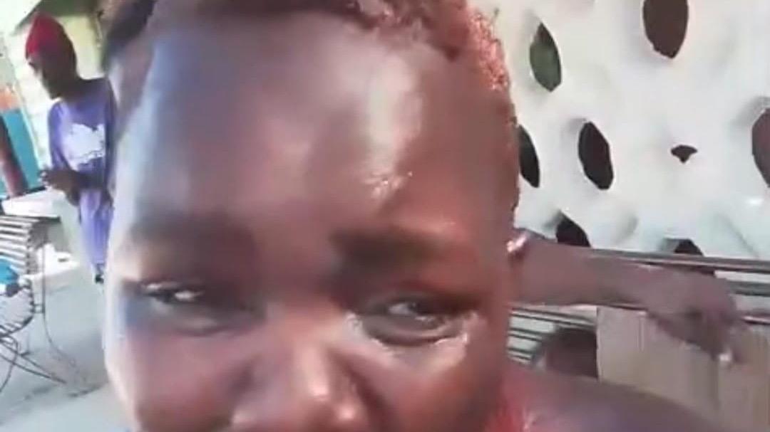 Hombre haitiano agrede a su expareja con aceite caliente en Jimaní